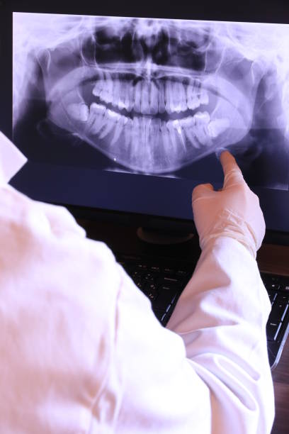 Best Emergency Tooth Extraction in Garwood, NJ